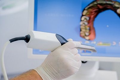 Escáner intraoral фото 1