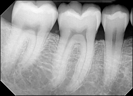 Radiographie ciblée фото 1