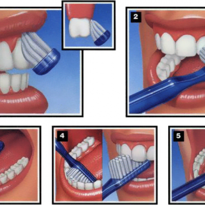 Com rentar-se les dents correctament