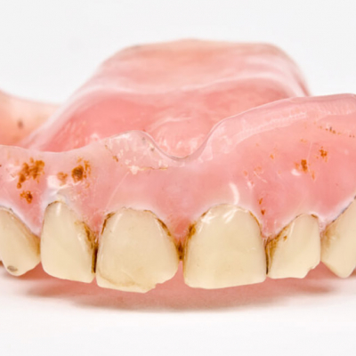 Why do removable dentures turn black?