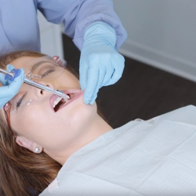 Под каким наркозом ставят импланты зубов в Барселоне?