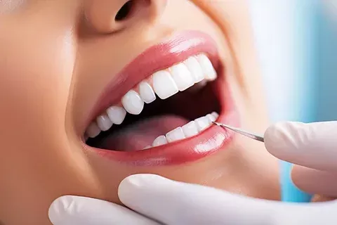 Estética dental фото 1