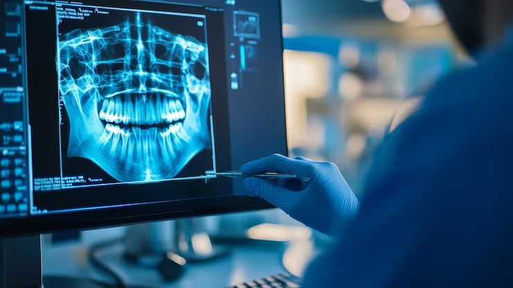 Implantes Dentales фото 2