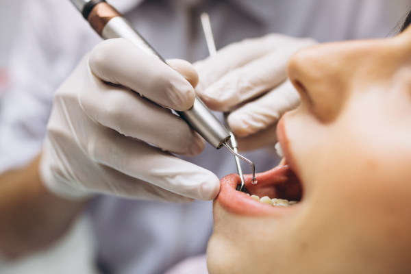 Escáner intraoral