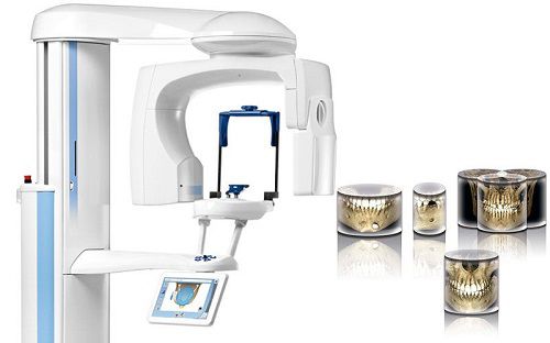 Počítačová tomografie zubů a čelistí фото 1